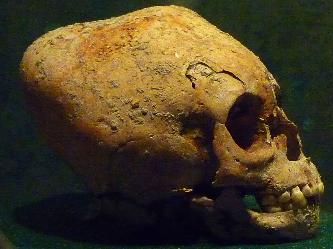 Side view of a Maya skull in a museum case, the braincase sloping steeply back from the brow in a long tapered shape, against a dark green background