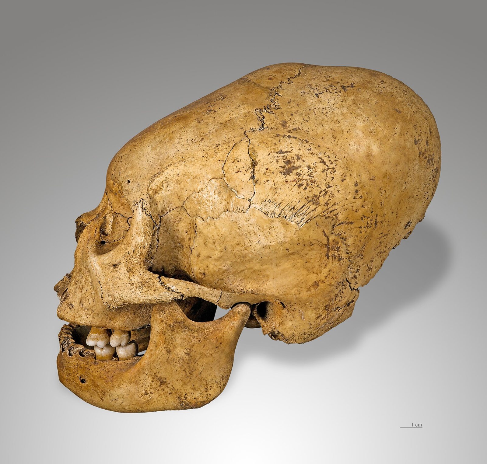 Side view of an adult skull from Nazca, Peru, with a long braincase swept up and back from a low forehead, shown with its lower jaw and a 1 cm scale bar on a grey background