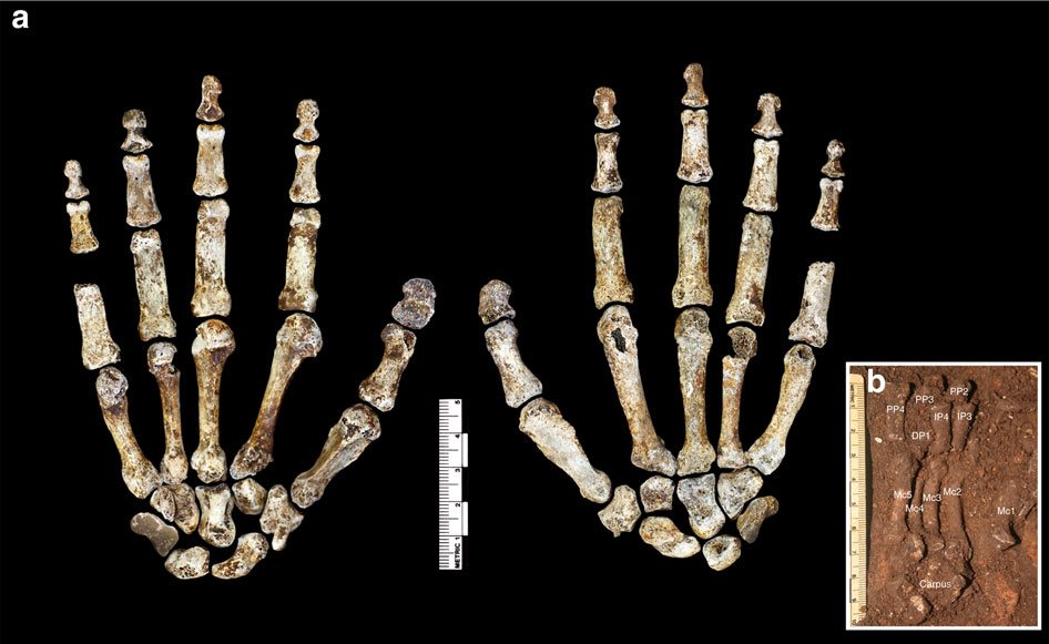 Two views of the right hand bones of Homo naledi on a black ground, palm side at left and back of the hand at right, with a scale bar and a small inset photograph of the bones lying in the cave soil