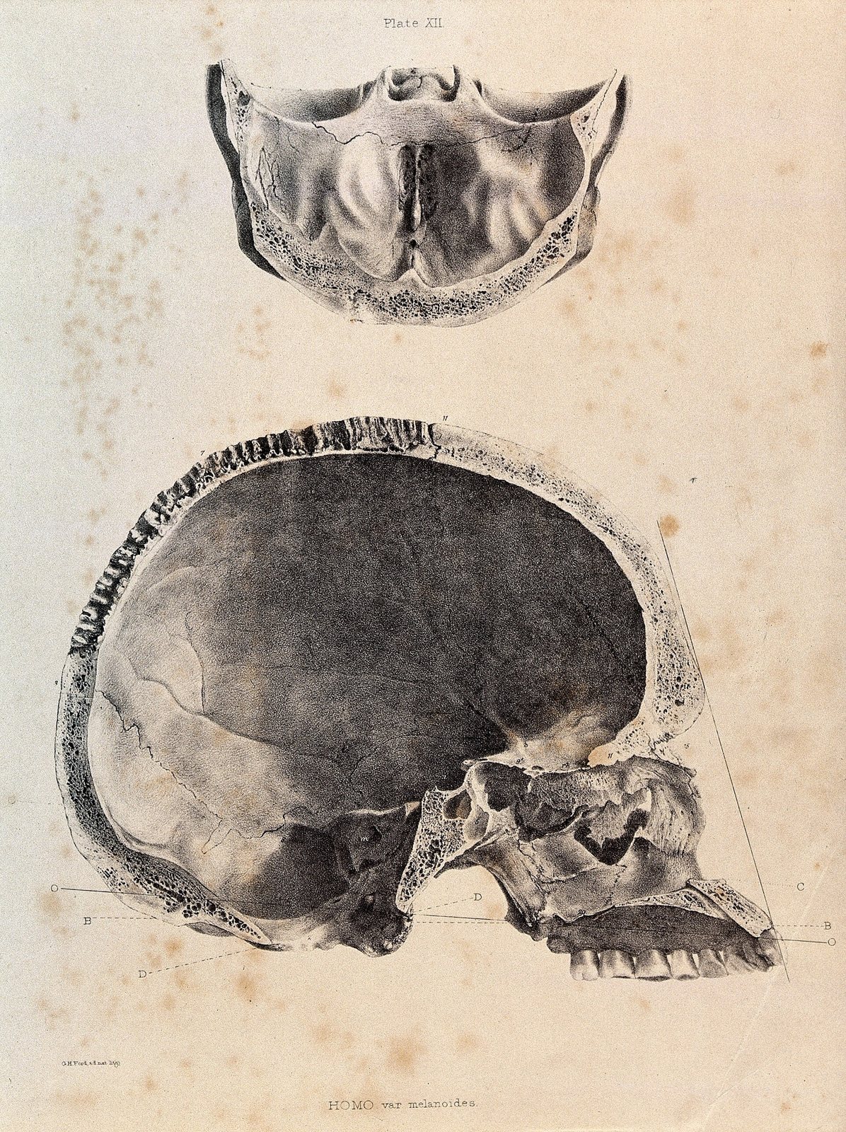 A lithograph of a human skull cut in half from front to back, with a smaller cut piece of the skull base above it, showing the thickness of the bone around the empty cranial cavity