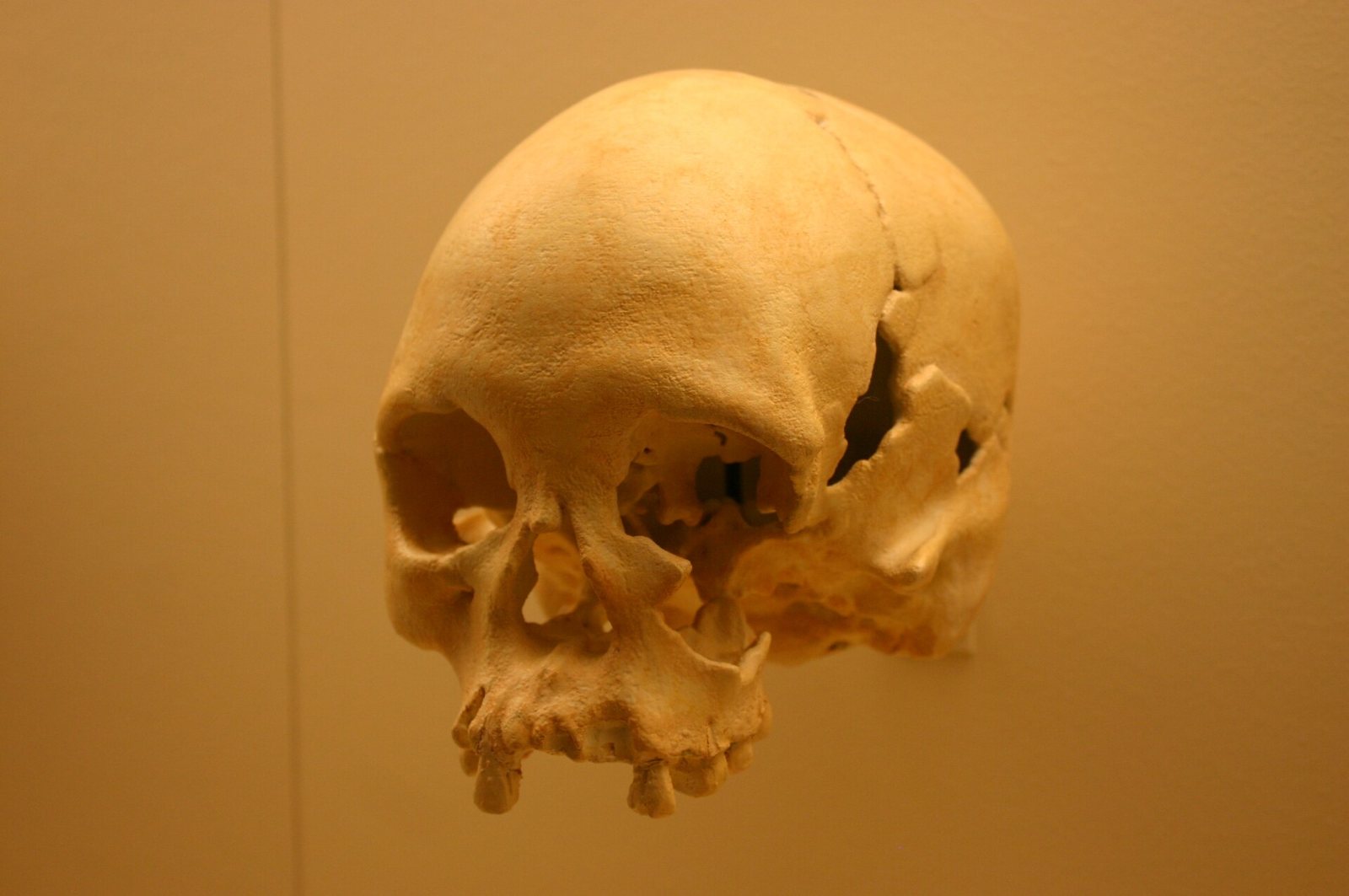 A cast of the skull known as Luzia, pale cream and with a break on the right side of the cranium, lit against a warm orange wall in a museum case