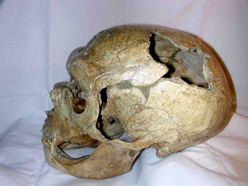Side view of the La Chapelle-aux-Saints Neanderthal skull on white cloth, long and low with a heavy brow, a mended gap over the temple and a rounded bulge at the back