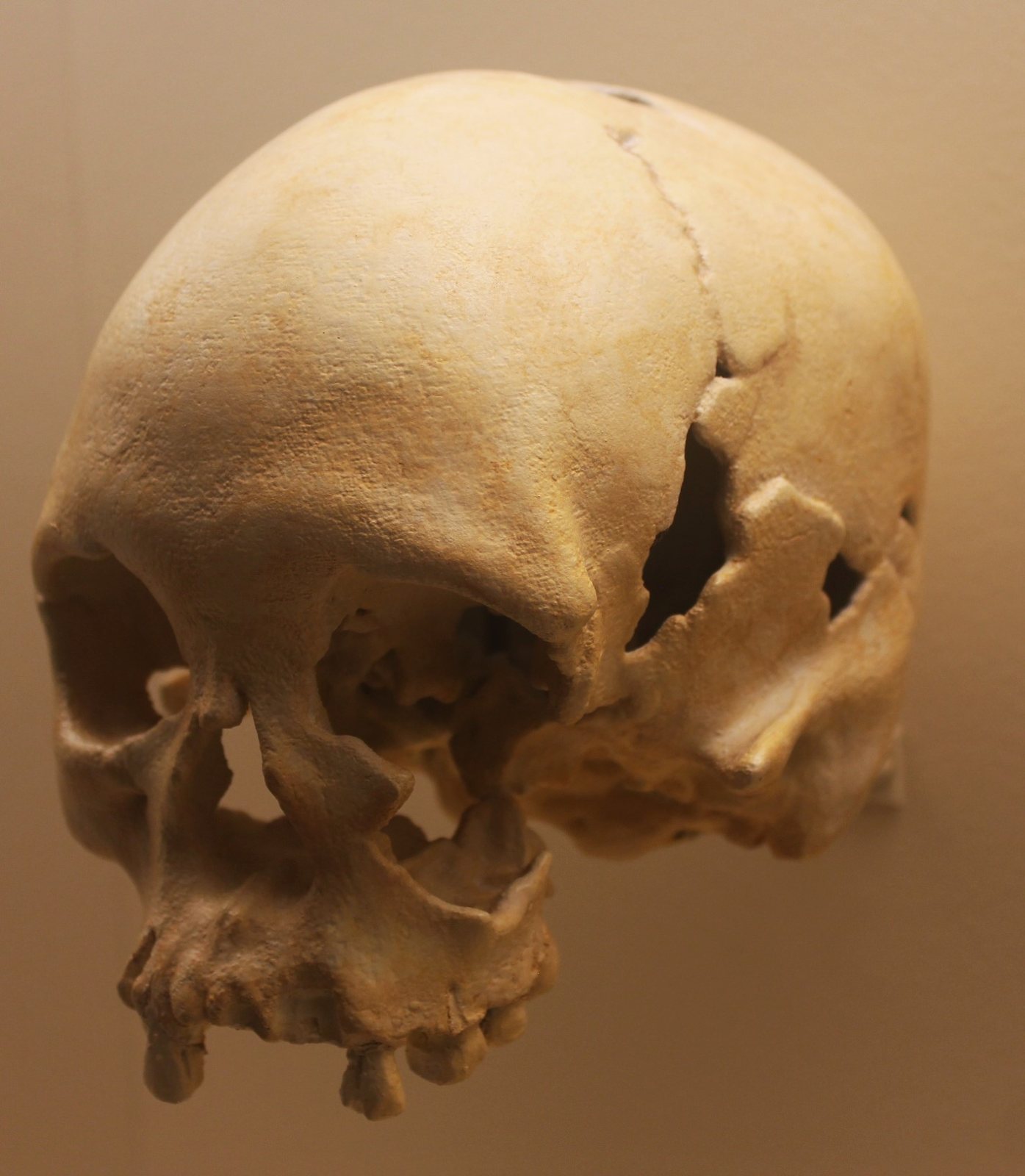 Cast of Luzia's skull seen from above and the left, a rounded cranium with the upper jaw and a few teeth, against a warm beige background