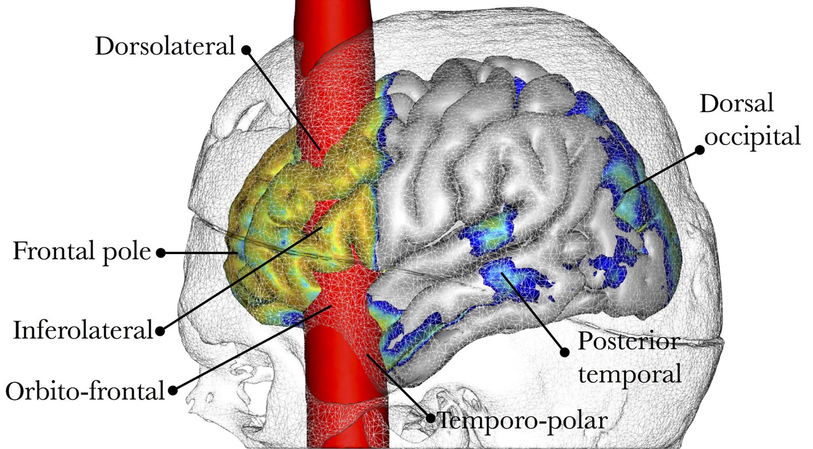 A 3D model of Gage's skull as a see-through mesh with a grey brain inside, a red column marking the bar's path through the front of the brain and labelled regions coloured yellow and blue