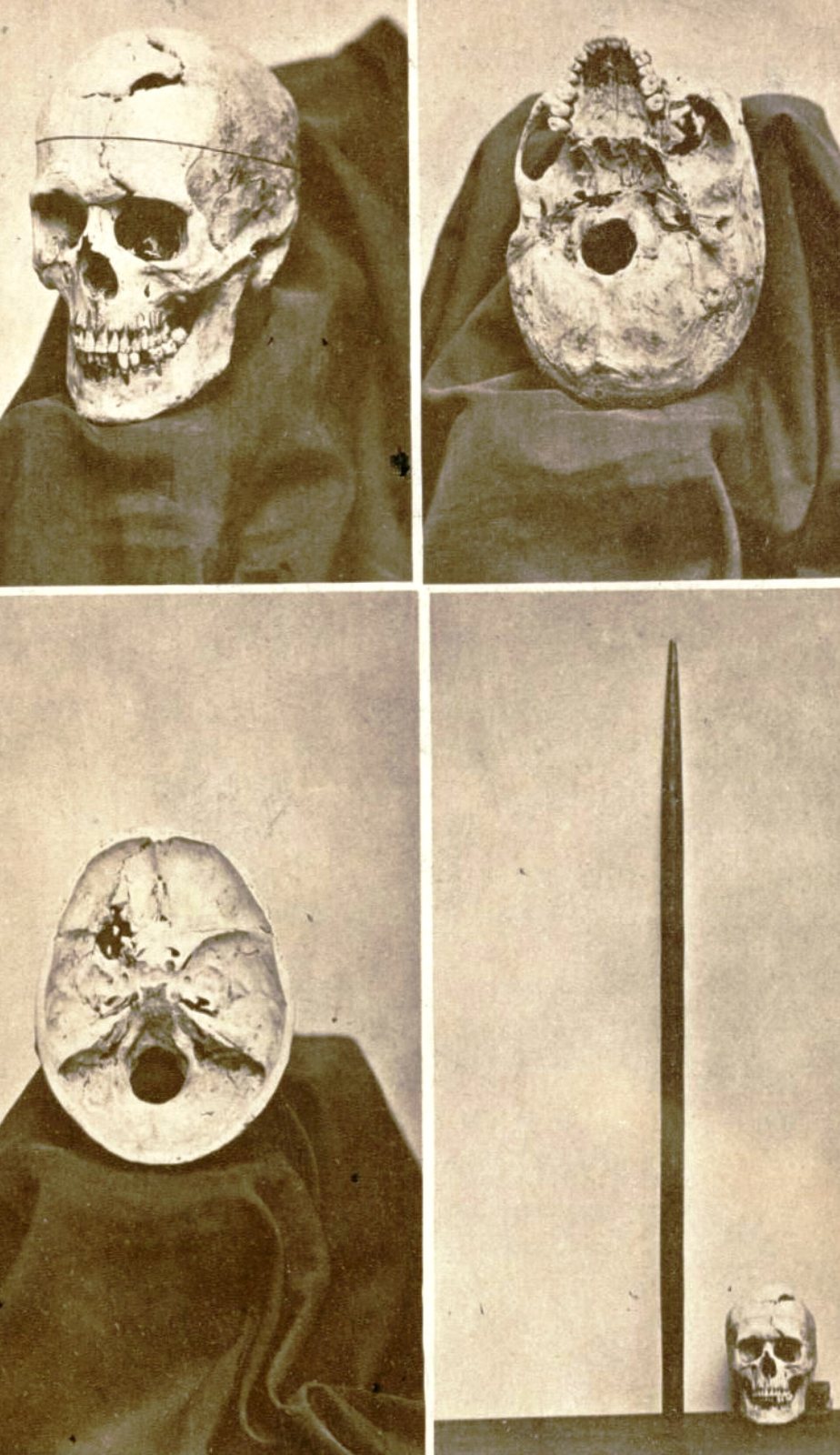 Four sepia photographs on one page: Gage's skull from the front left, from below, the inside of the skull base, and the skull standing small beside the tall tamping iron