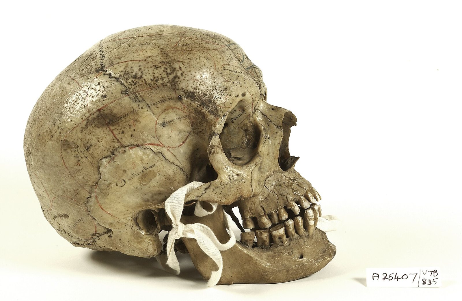 A human skull seen from the side on a white background, its cranium marked with faint ink outlines and handwritten French labels, the jaw tied on with white tape and a catalogue label beside it