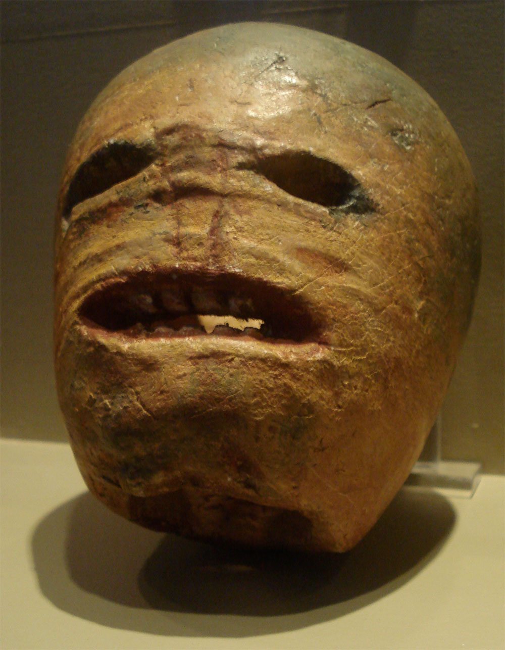 A carved turnip lantern with hollow eyes and a wide open mouth showing a few teeth, on display against a dark background